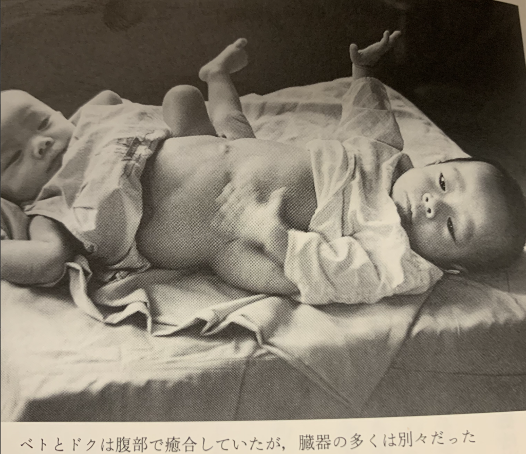 戦争 枯葉 剤 ベトナム “3世代”にわたり奇形児が生まれ続けるベトナム戦争「枯葉剤」の悲劇写真10選！ 米国の残酷な戦争犯罪とは？