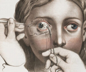 麻酔なしで行われていた拷問レベルの手術・治療法を紹介!