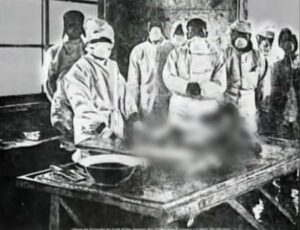 人体実験を行なったのは731部隊だけではなかった!?